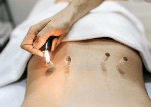 Séance de Moxibustion, méthode pour réchauffer des points corporels